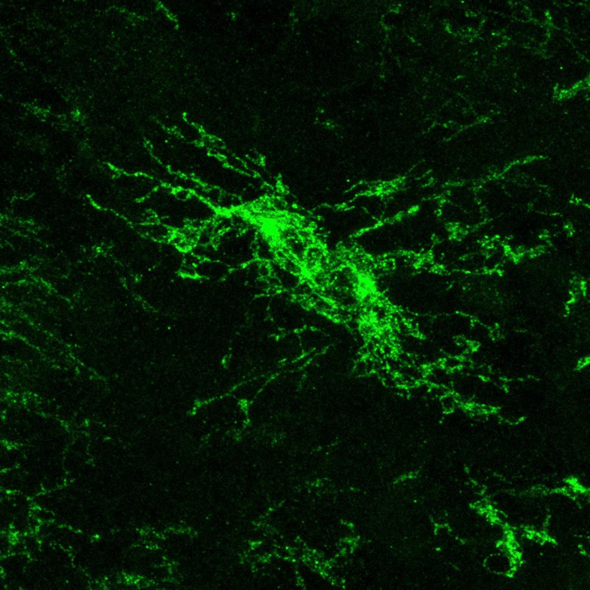 Oligodendrocyte precursor cells (OPCs) in vivo. Image by Erin Gibson..jpeg