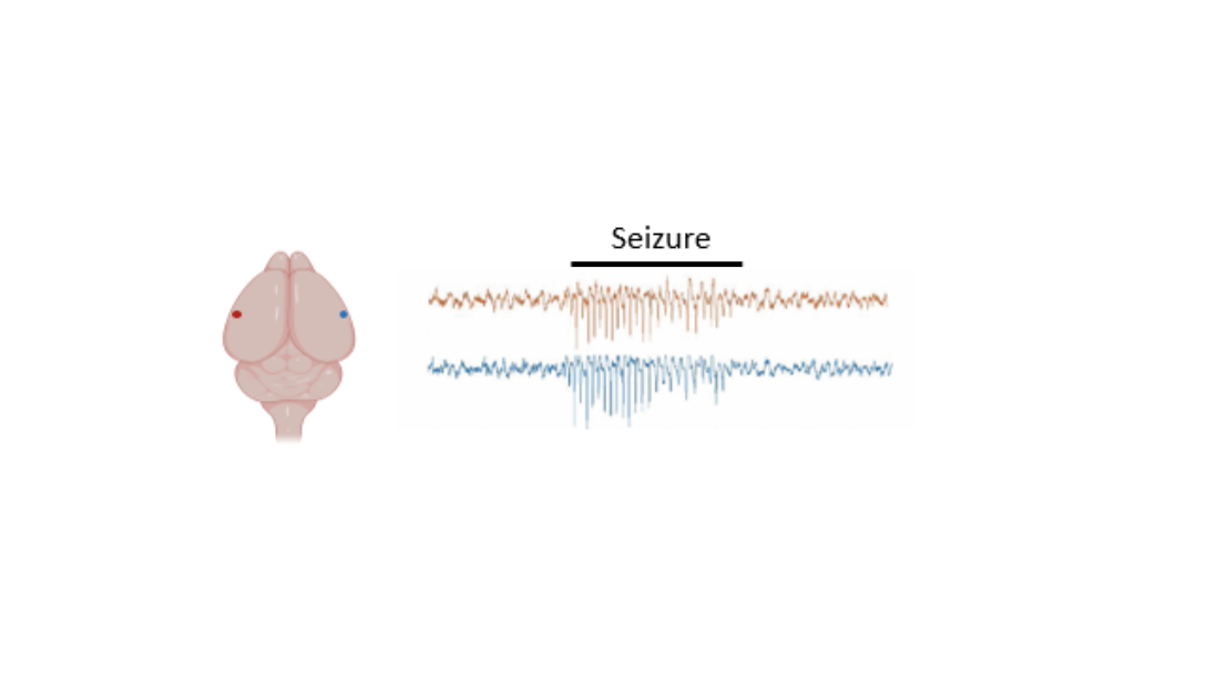 Snapshot of a mouse EEG showing a seizure. Image by Juliet Knowles.