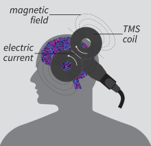 TMS in action (Labeling for magnetic field, TMS coil, and electric current)