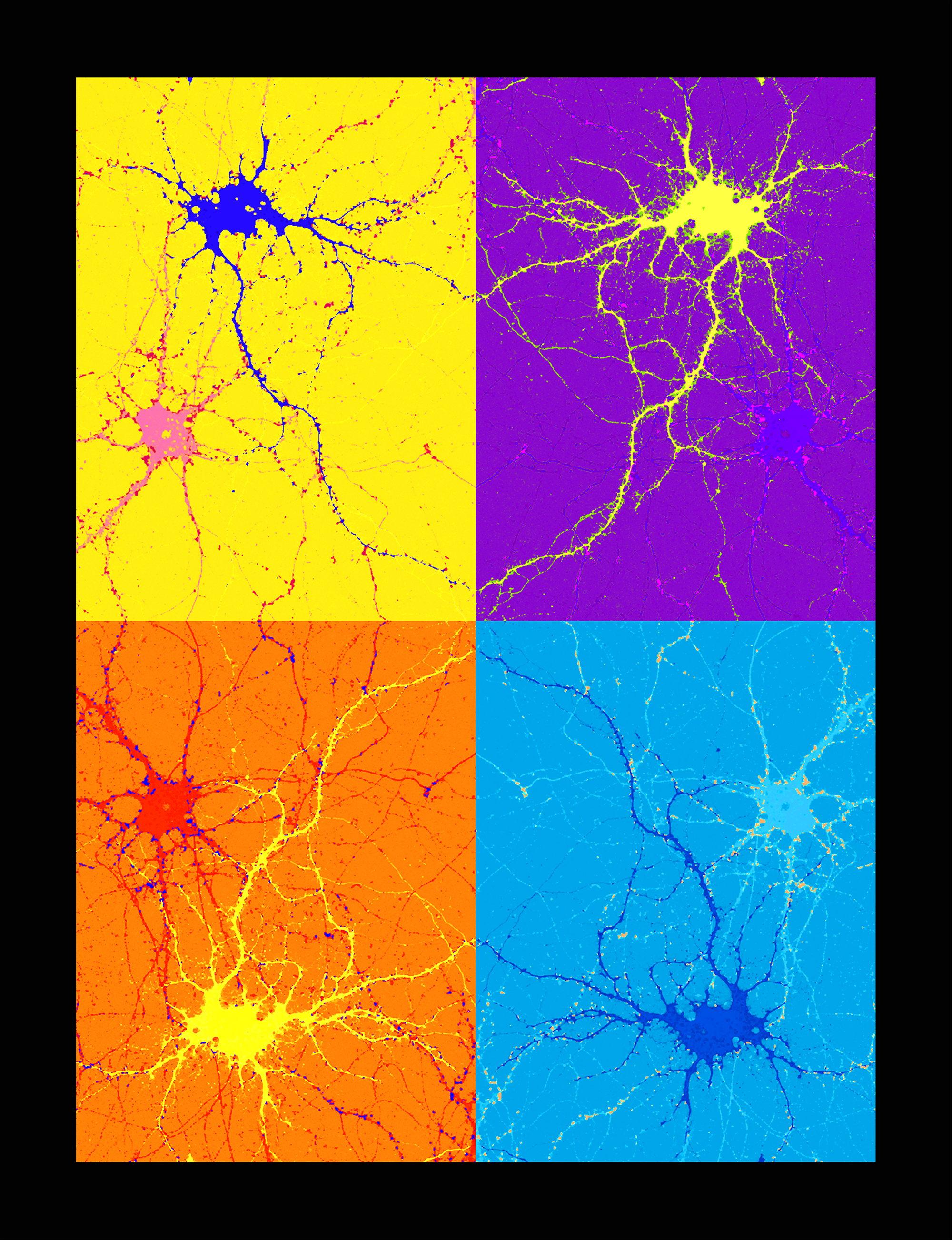 Art of Neurosciences, Stanford Neurosciences Institute