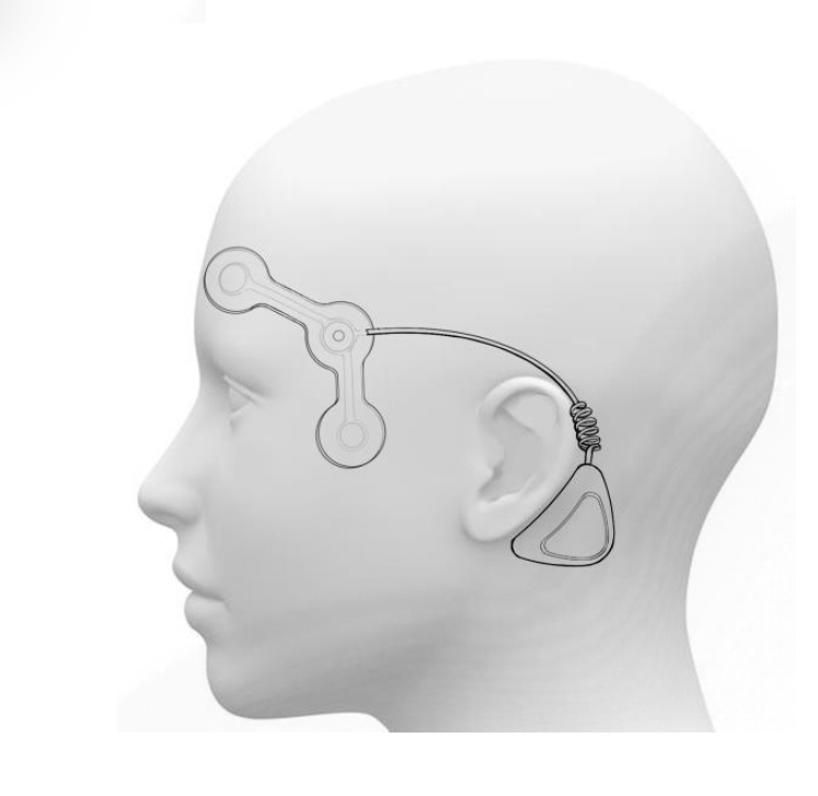 Rendering of wearable ENG device for measuring vestibular brain activity