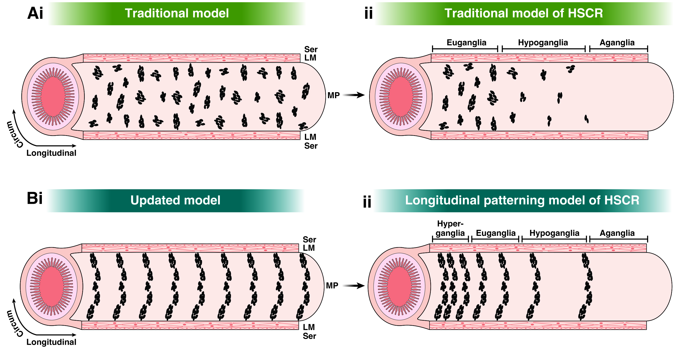 Figure showing revised model of gut nervous system development in which failure to properly develop stripes could contribute to GI disorders