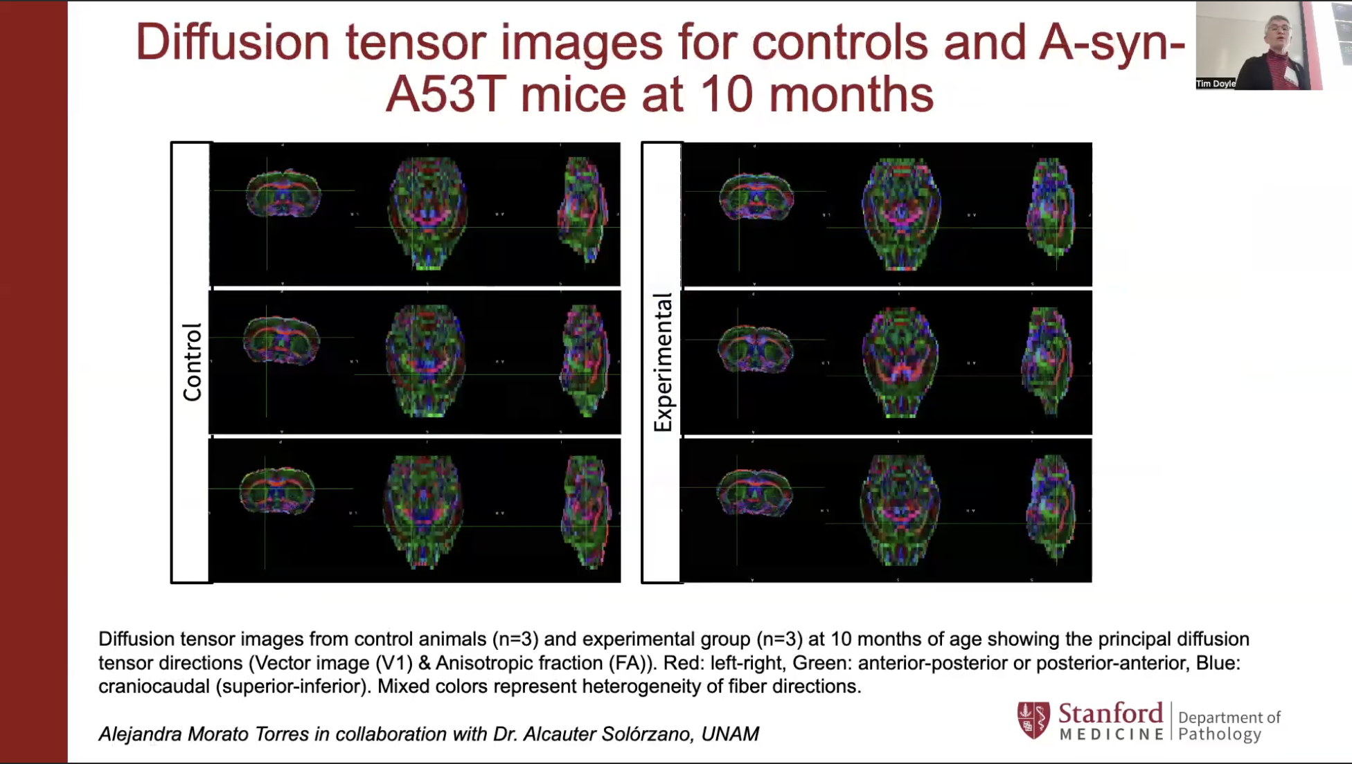 Birgitt Schuele presents early data from her research, comparing diffusion tensor images of control animals with those from an experimental group at 10 months of age to measure functional connectivity in alpha-synuclein mice. Image by Alejandra Morato Torres in collaboration with Alcauter Solorzano.