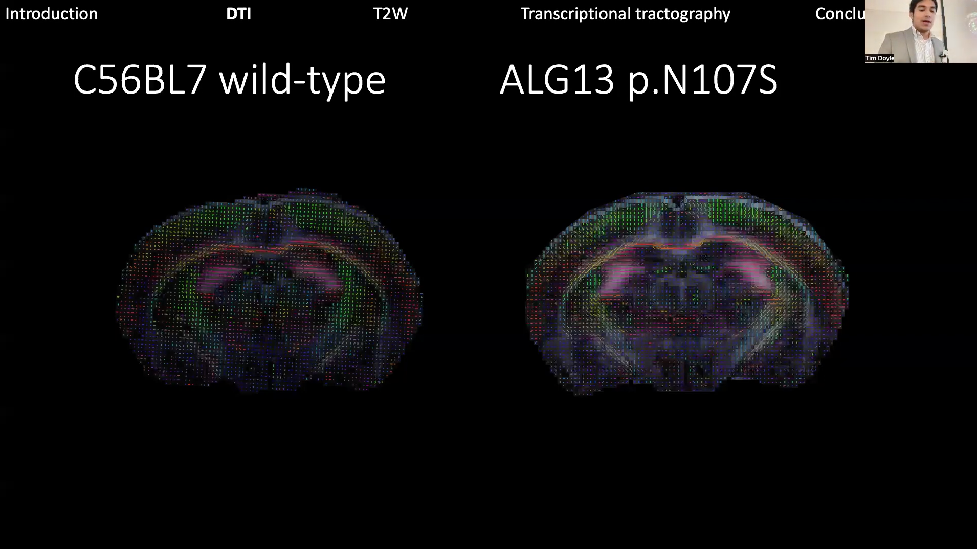 Richard Coca uses diffusion tensor imaging to highlight differences in the hippocampus of the mouse model.