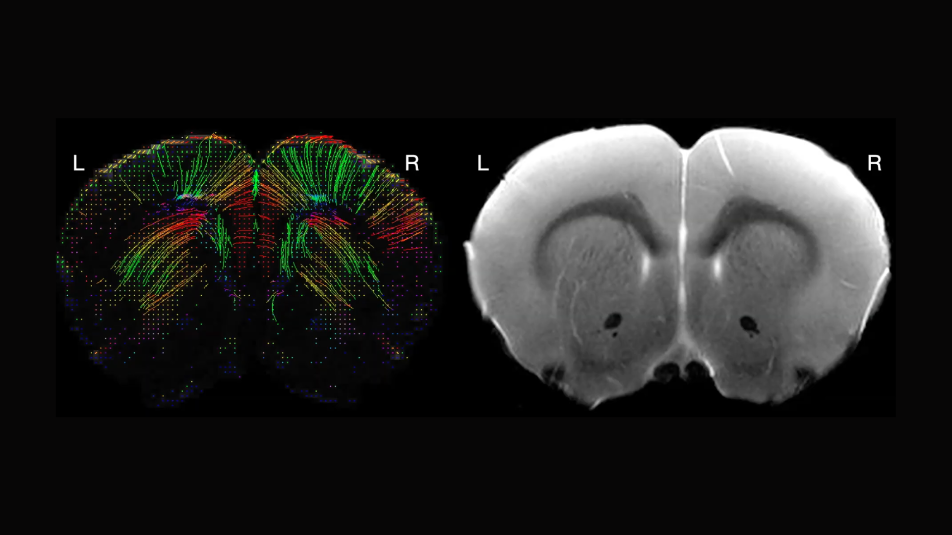Vanessa Doulames shares her research data on asymmetries in cortical sensorimotor regions on a rat model using diffusion tensor imaging. Image by Vanessa Doulames.