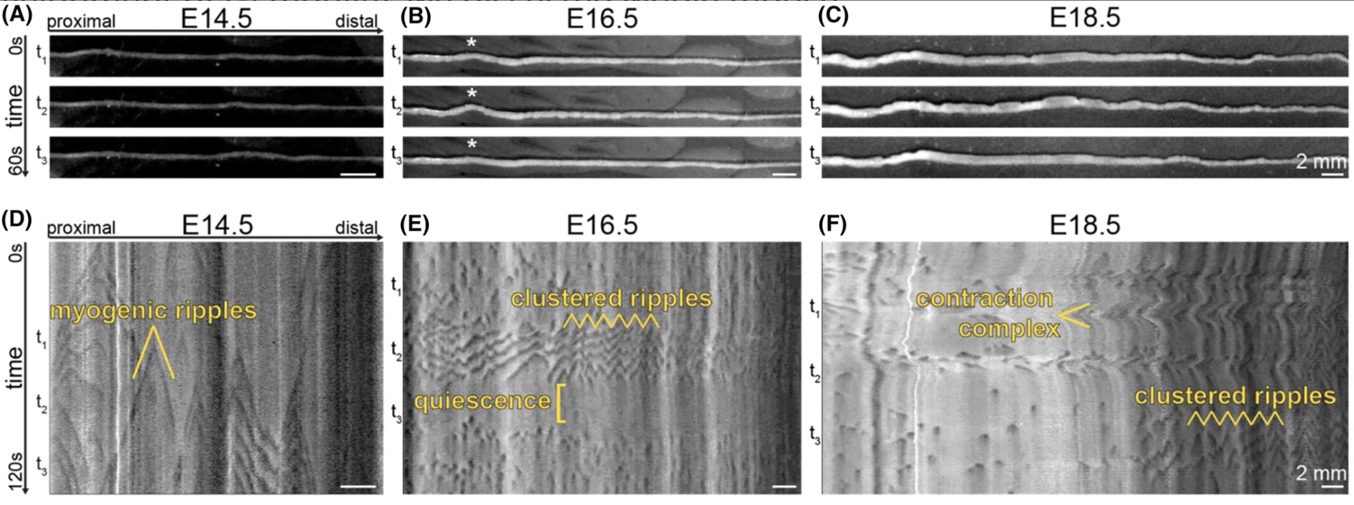 Research figure showing newly discovered ripples in the developing mouse intestine