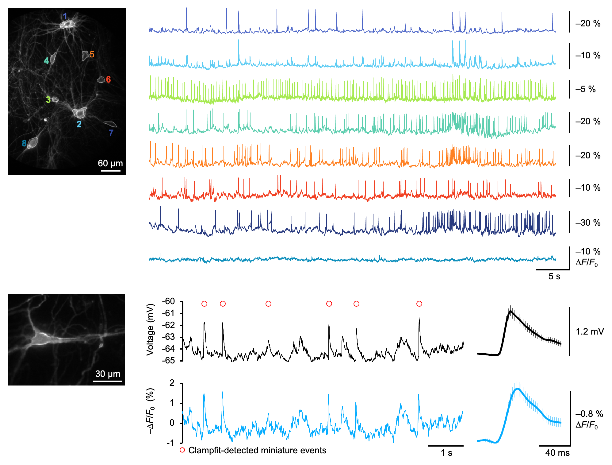 Voltage imaging in human neurons