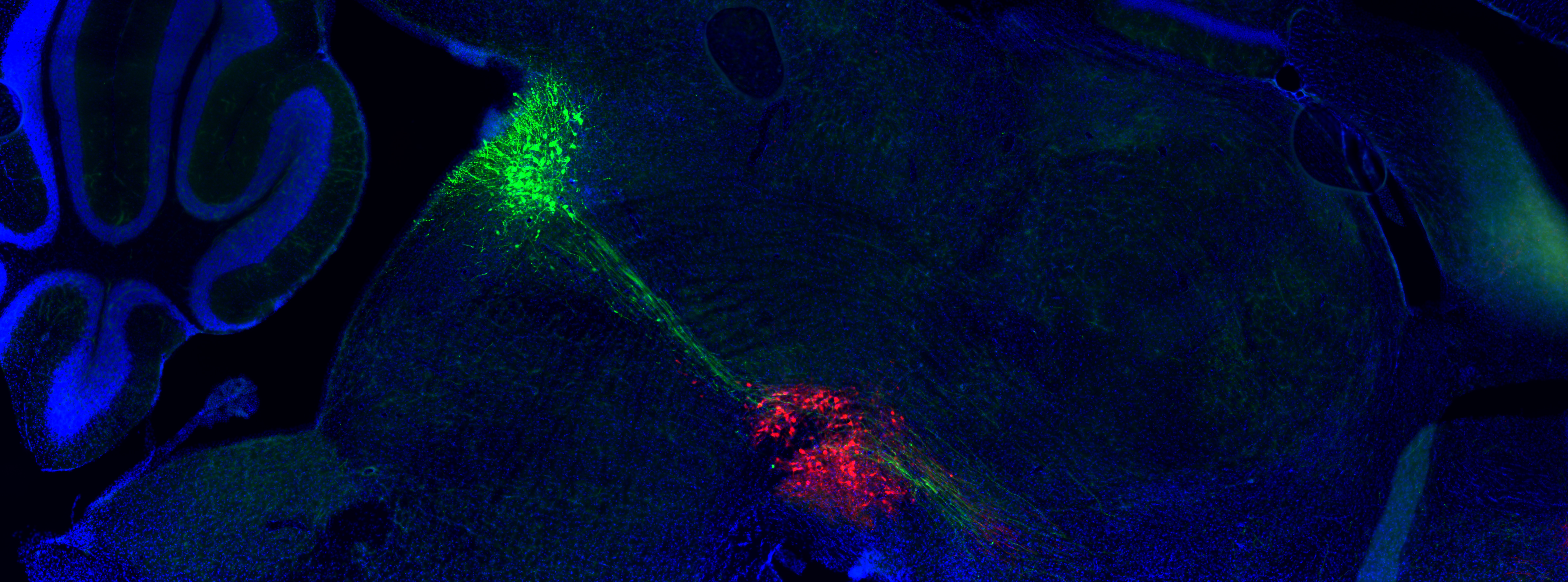 Research image showing overlapping green and red neurons in a dark brain slice