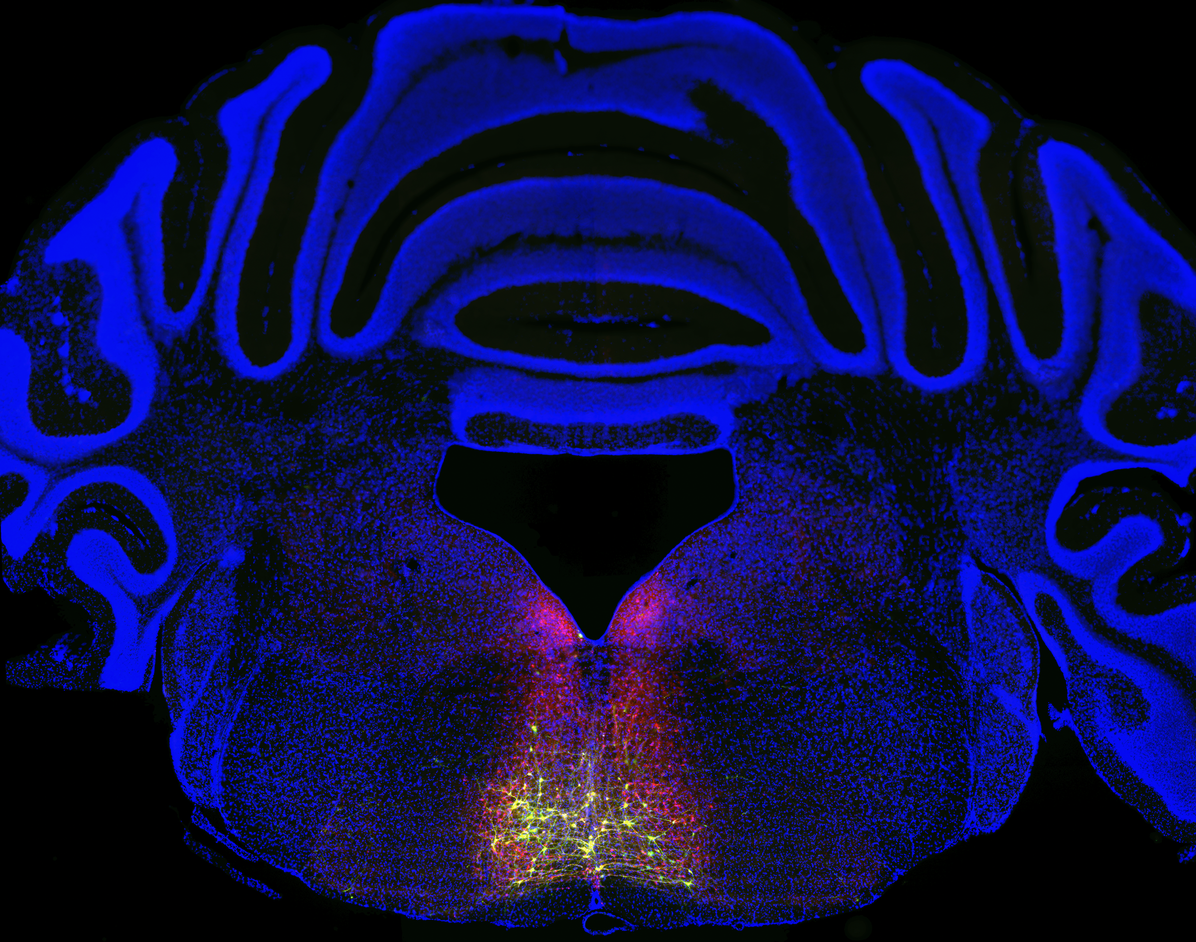 Blue folds wrap around a central region with red and yellow dots, outlining neurons in the brain.