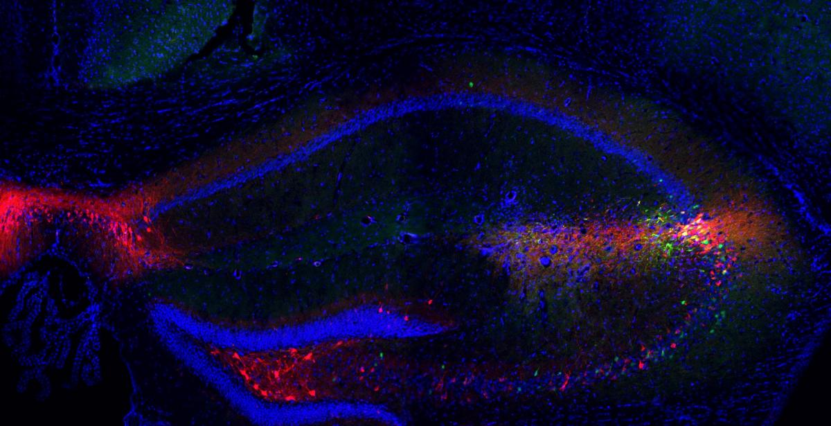 Microscope image shows medial septum neurons (magenta) projecting into the brain's social memory centers
