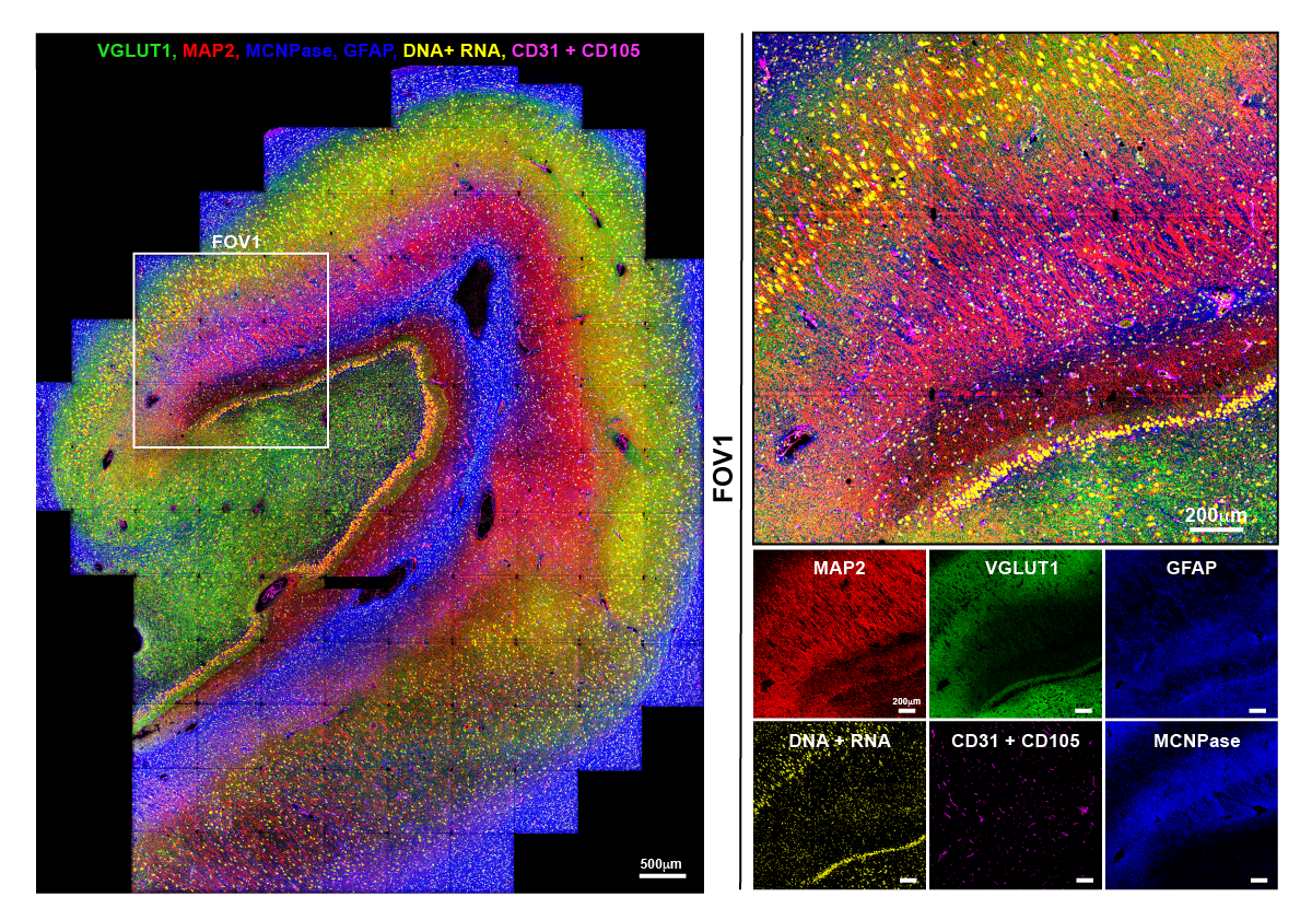 Molecular imaging of hippocampus using multiplexed ion beam imaging (MIBI)