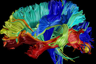 24 brain regions 