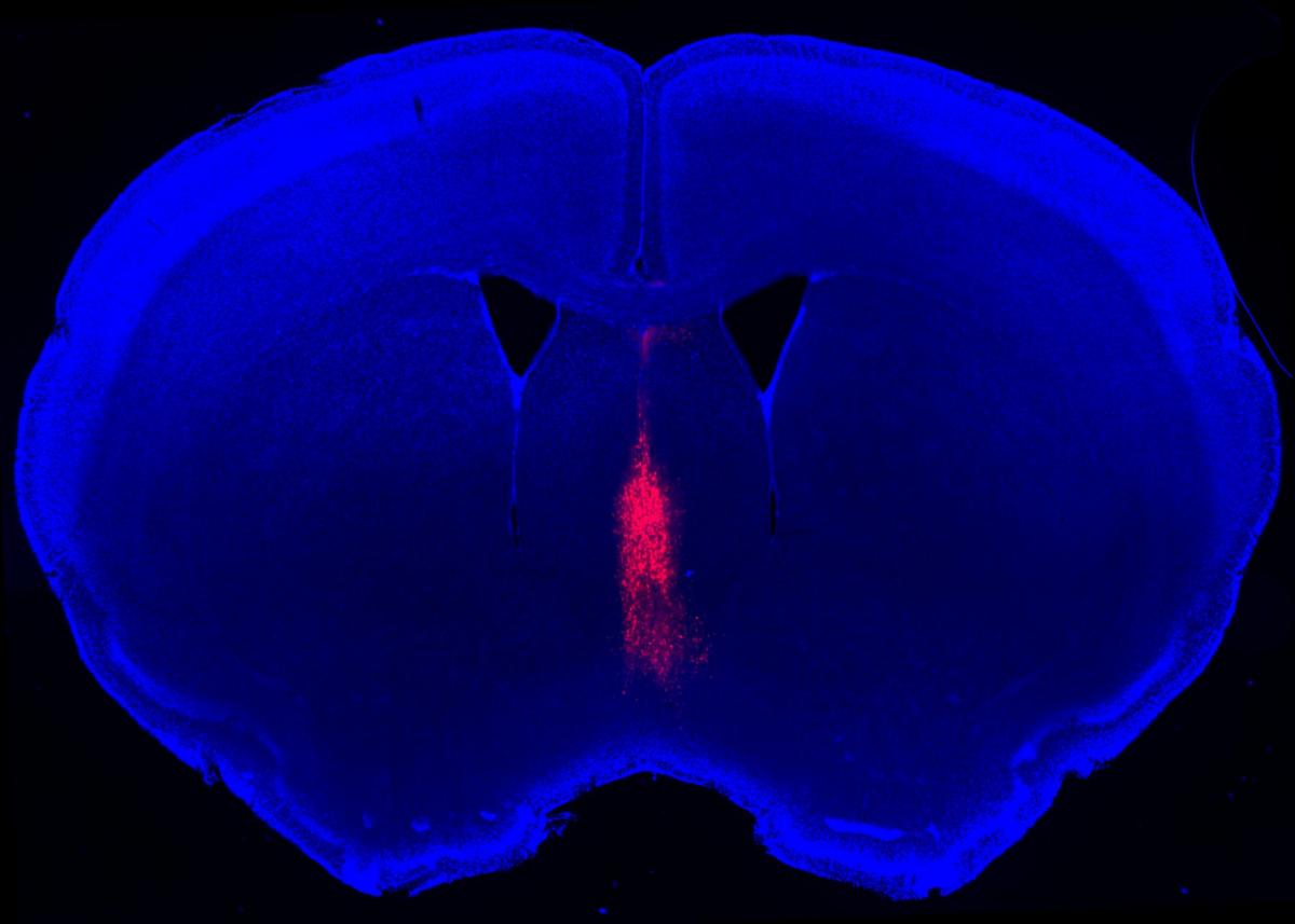 Medial septum neurons (magenta) in the center of a mouse brain slice