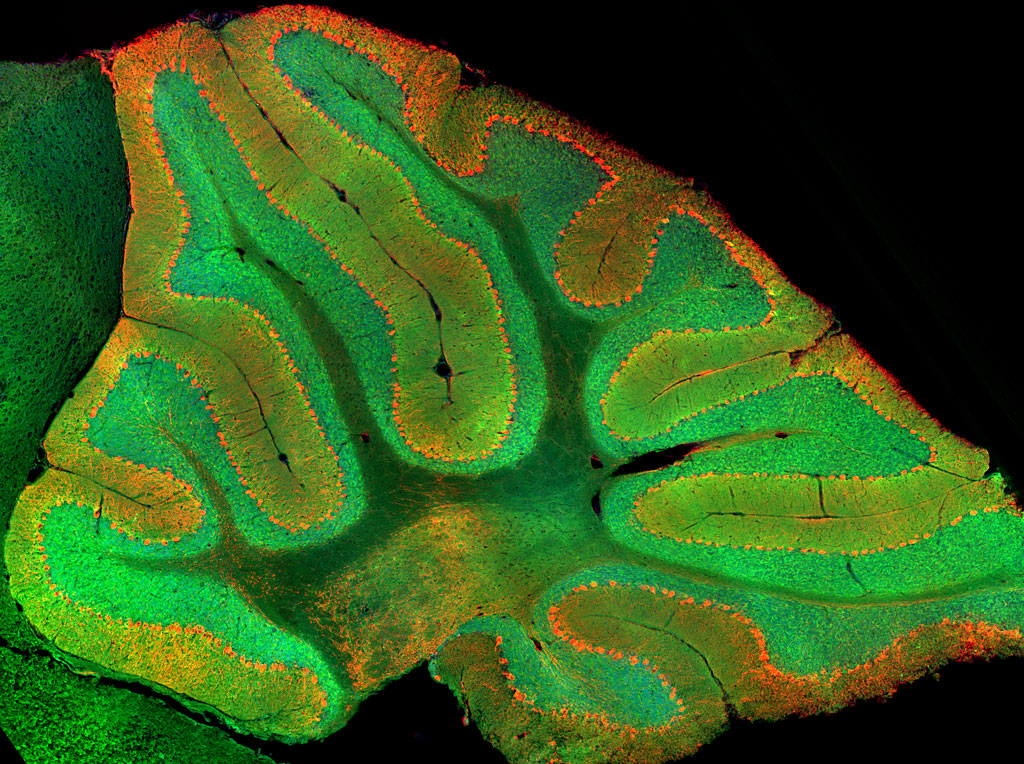 cerebellum granule cells