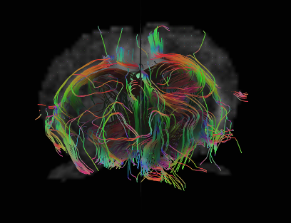 MRI rendering reveals nerve pathways in a mouse brain