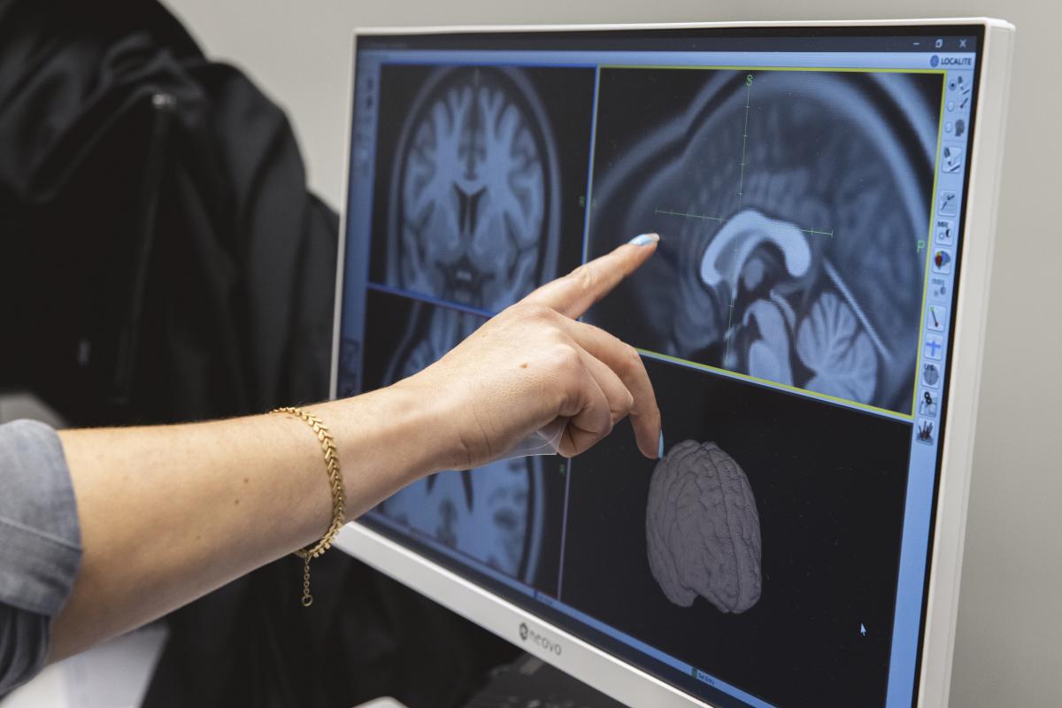 Hand pointing at a brain scan being used to target transcranial magnetic stimulation