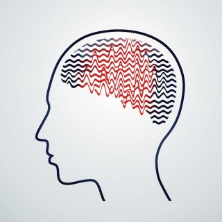 Temporal lobe epilepsy