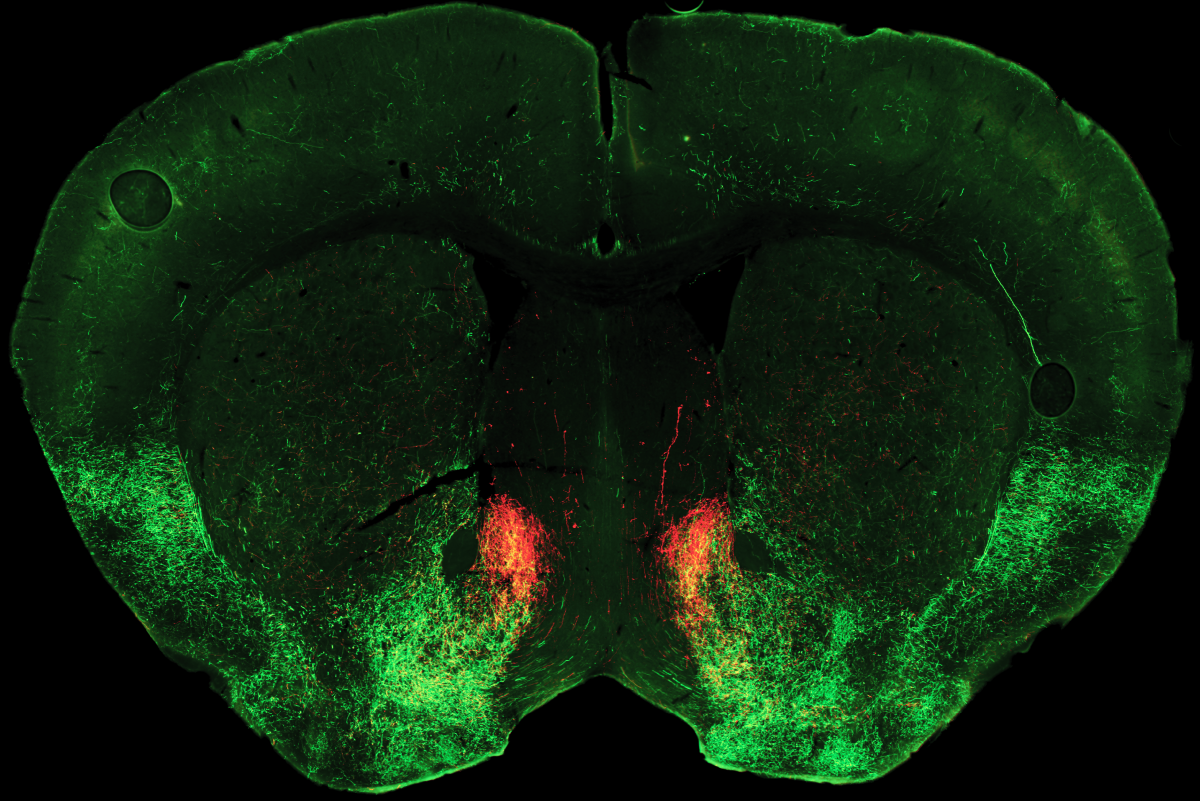 Mouse brain cross-section showing serotonin-releasing (green) and dynorphin–releasing (red) fibers terminating in the nucleus accumbens