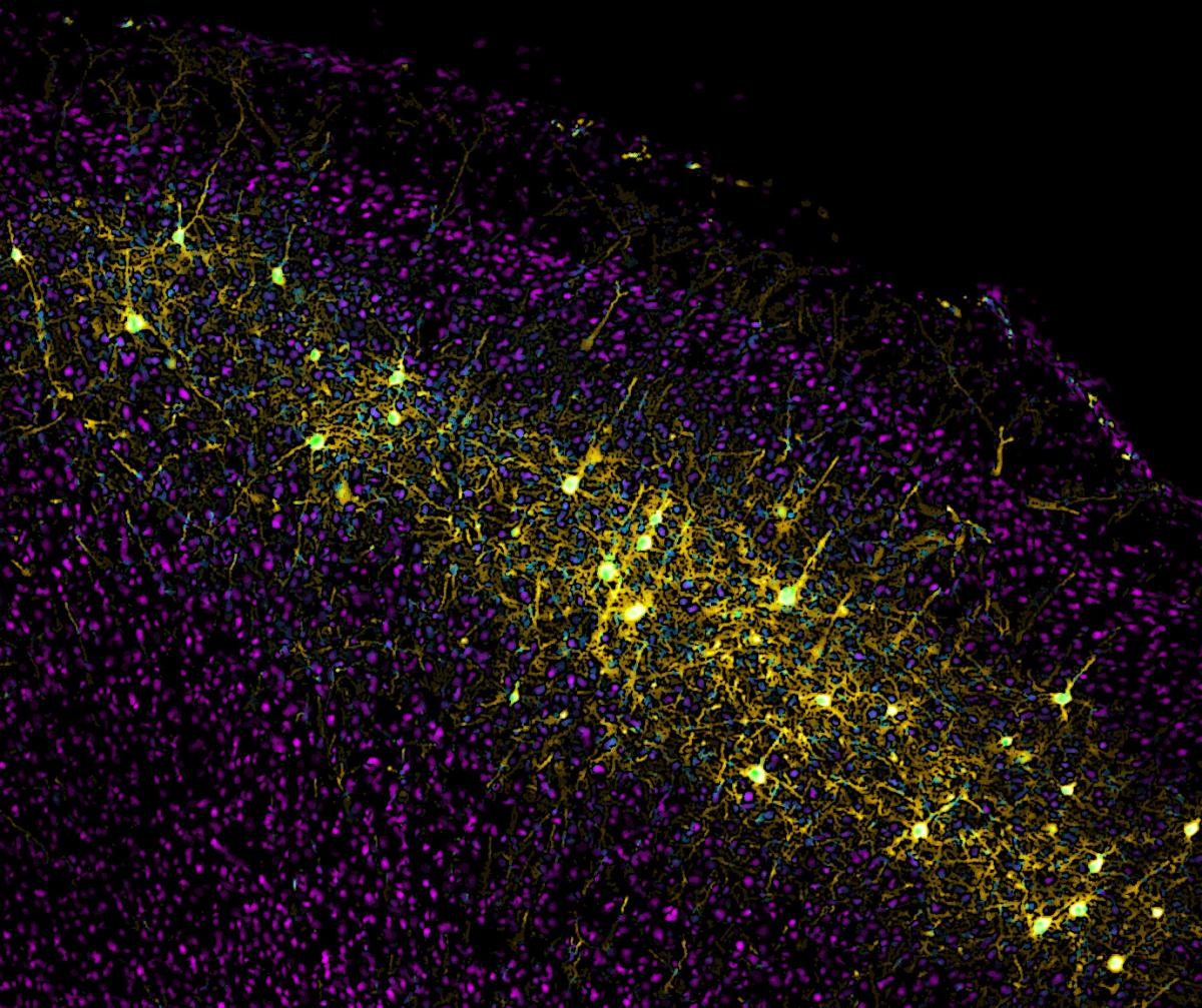 A particular population of neurons labeled in yellow by Wall's monosynaptic rabies virus system
