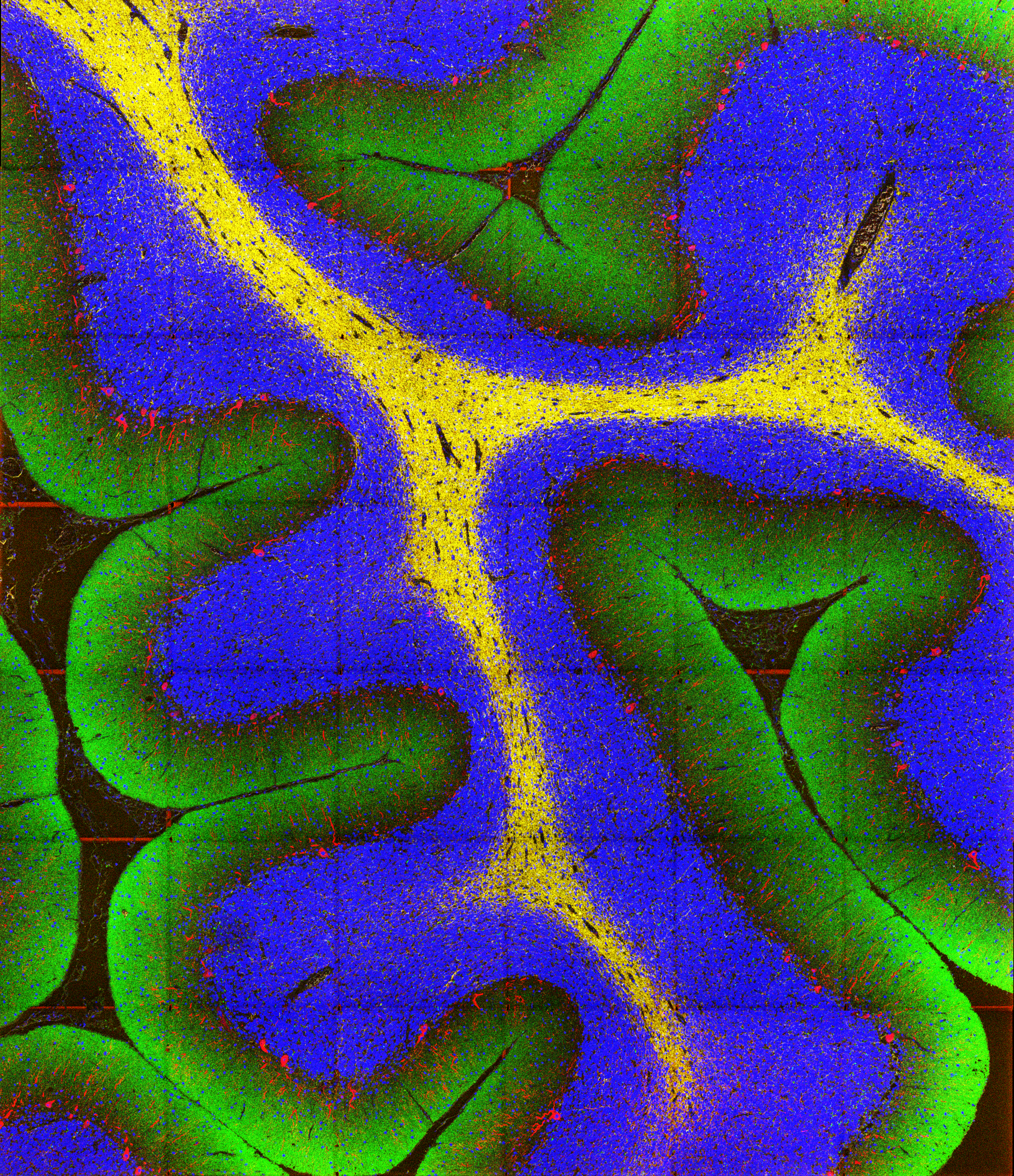 overlay_cerebellum.png