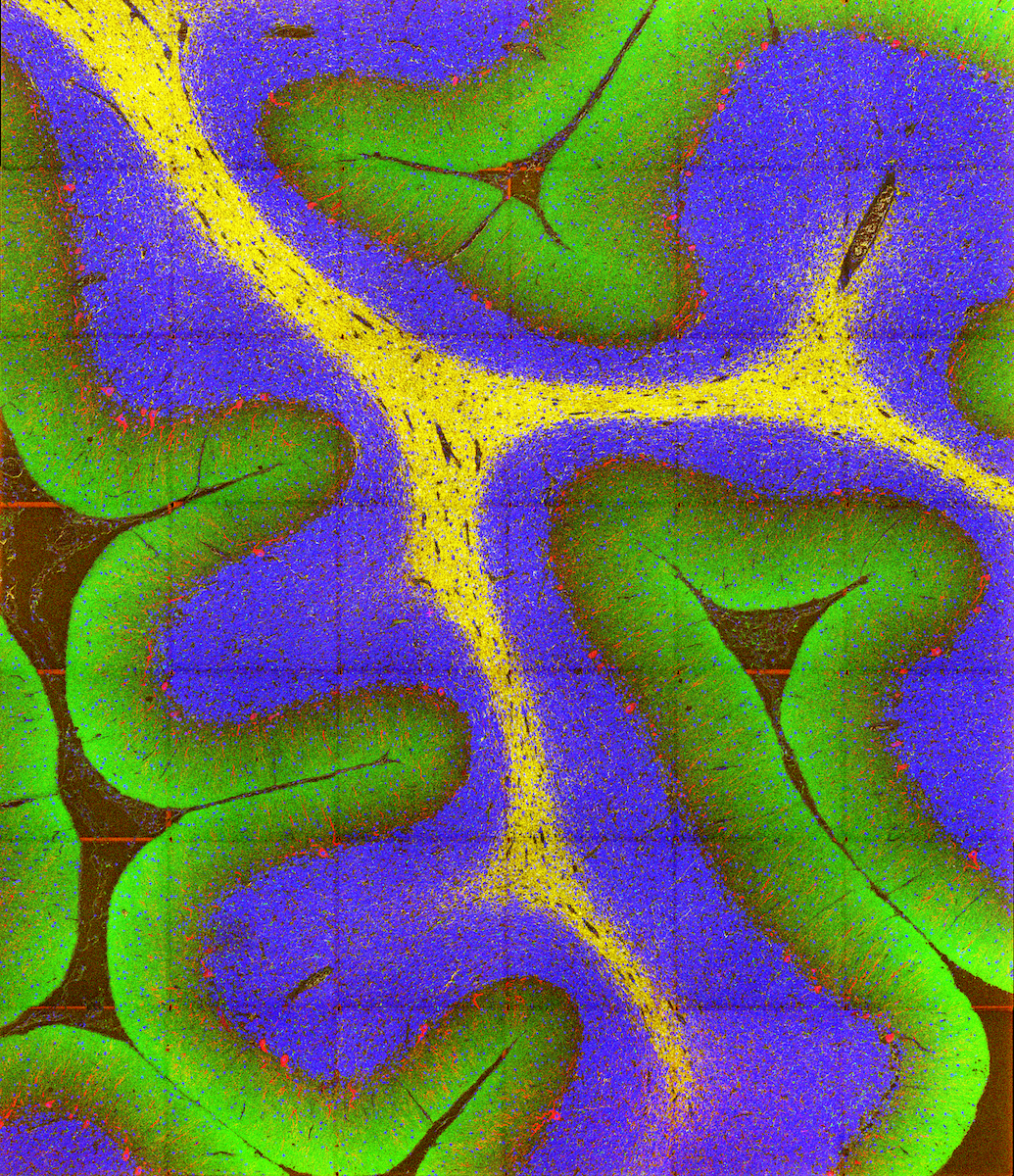 Molecular imaging of cerebellum using multiplexed ion beam imaging (MIBI)