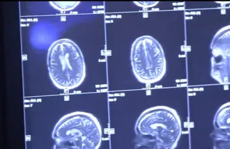 MRI brain scans, Wu Tsai Neurosciences Institute, NeuroHealth