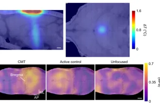 Thermal simulations and pressure distribution at the skull. (A) Temperature rise (heatmap) for the central medial thalamus (CMT) target simulated in k-Wave using a synthetic model of the wearable array and a segmented CT scan of a rat head. The plots display a sagittal and an axial view.