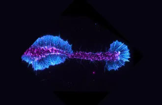 Image of actin filaments (cyan) and an actin regulatory protein (magenta) in a differentiating oligodendrocyte.