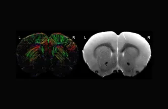Vanessa Doulames shares her research data on asymmetries in cortical sensorimotor regions on a rat model using diffusion tensor imaging. Image by Vanessa Doulames.