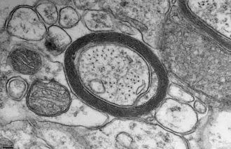 A dark ring of myelin in a black and white image of a cell.
