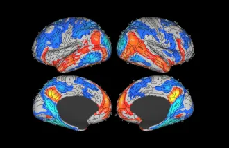 Brain scan images with some regions highlighted in reds and blues.