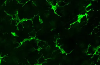 A microscope image of microglia in green.