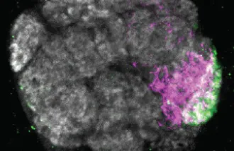 A microscope image of the olfactory system of a fruit fly brain, with portions highlighted in magenta and green.