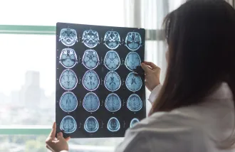 A woman in a white coat examines medical images of the brain.