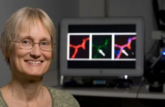 Katrin Andreasson immune cells as driver of mental aging