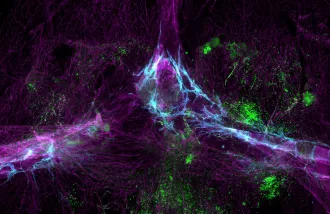 grey matter and brain's immune system