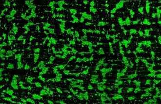 Neuronal grid in the human duodenum at 19 gestational weeks