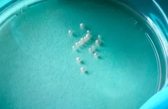 3-D brain cultures in a lab dish