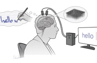 electrodes implanted in his brain imagined writing 