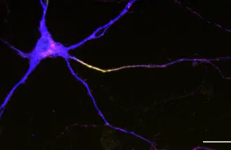 Mouse Neuron Shen Lab