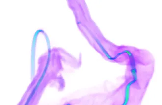 probe segment of mouse colon