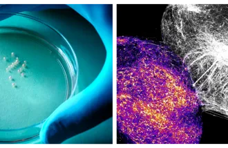 A gloved hand holds a Petri dish at left; a microscopy image at right.
