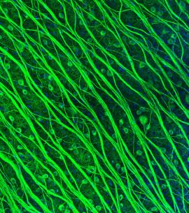 retinal ganglion cells, Stanford neurosciences Institute