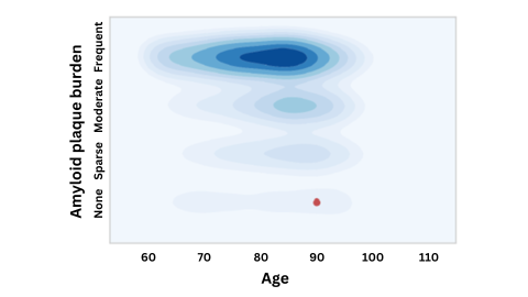 A figure emphasizing that an APOE-4 carrier with virtually no amyloid buildup at age 90 (red dot) is an extreme outlier compared to others with this gene variant. This suggests the APOE gene may have been "defused" by another, protective mutation.