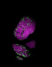 Light-sensitive proteins, or opsins