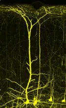 growth in the neurons involved in a mouse's visual system