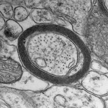 A dark ring of myelin in a black and white image of a cell.