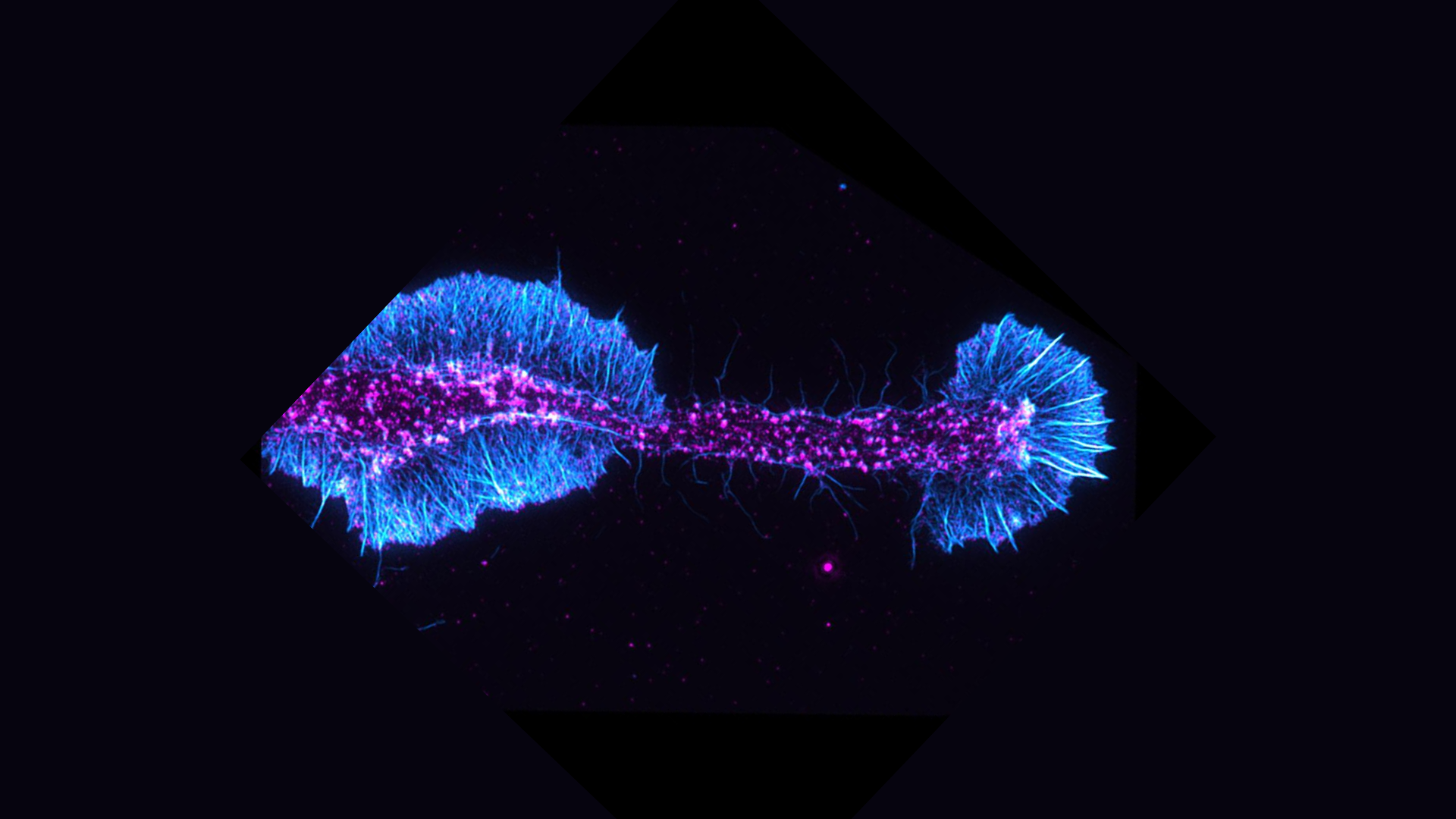 Image of actin filaments (cyan) and an actin regulatory protein (magenta) in a differentiating oligodendrocyte. Credit: Andrew Olson and Brad Zuchero, Neuroscience imaging core (before it was called Wu Tsai Nero’s Neuroscience Microscopy Service).