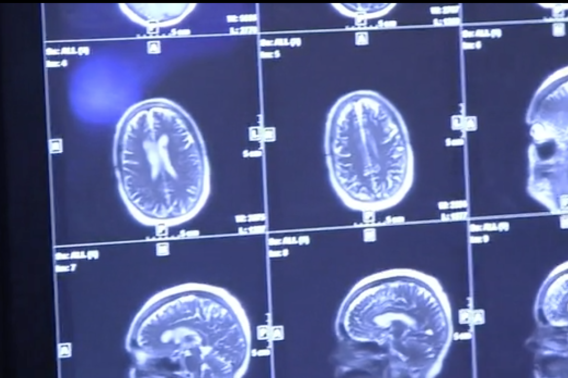 MRI brain scans, Wu Tsai Neurosciences Institute, NeuroHealth