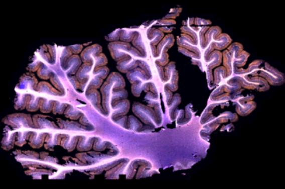 Akoya image of a cerebellum 